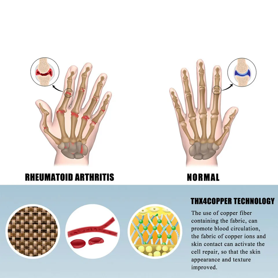1 Pár Dospelých Reumatoidnej Kompresie Ruky Rukavice Pre Artróza, Artritída Kĺbov Úľavu Od Bolesti Zápästia Podporu Obrázok 2